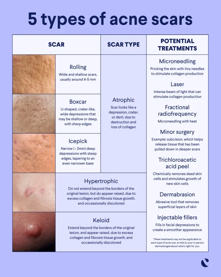 What are hypertrophic scars and what causes them? - Infographic