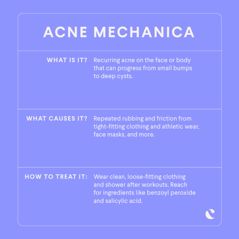 Acne Mechanica Definition Cause Treatment Options