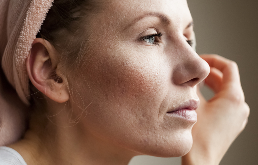 woman cleaning her face in the bathroom