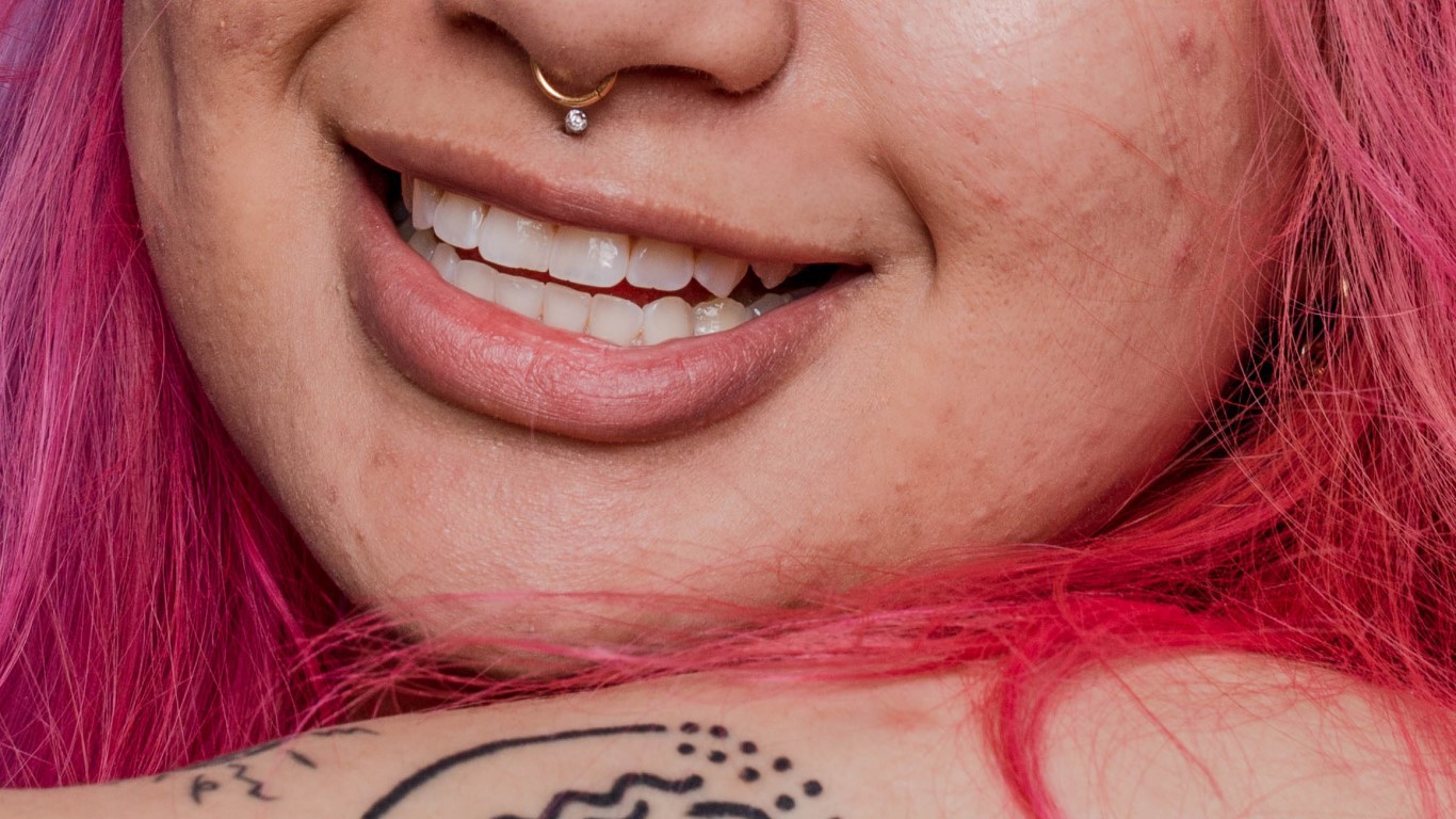 Woman with acne scars, cheek acne, and pink hair smiling 