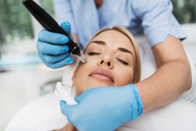 microneedle therapy on woman