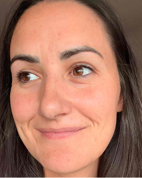 Alli - After 2 months