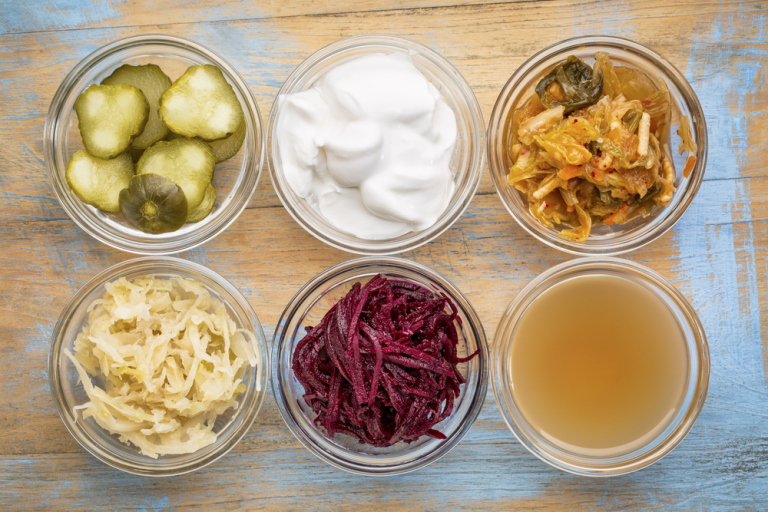 Image of probiotic foods