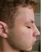 Trevor - Before