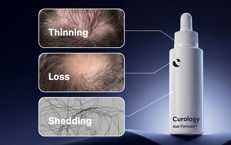 Homepage Hero Hair Loss MB