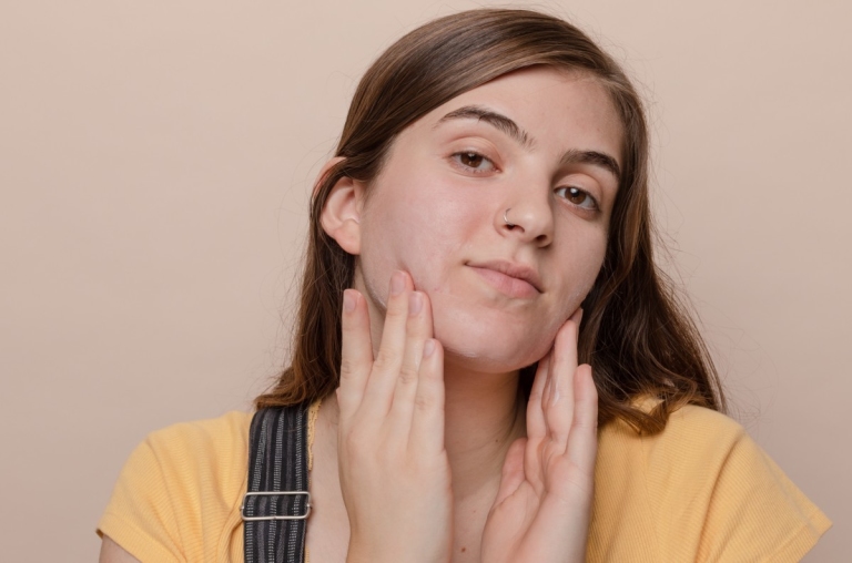 Teenager rubbing acne skincare custom formula onto her face