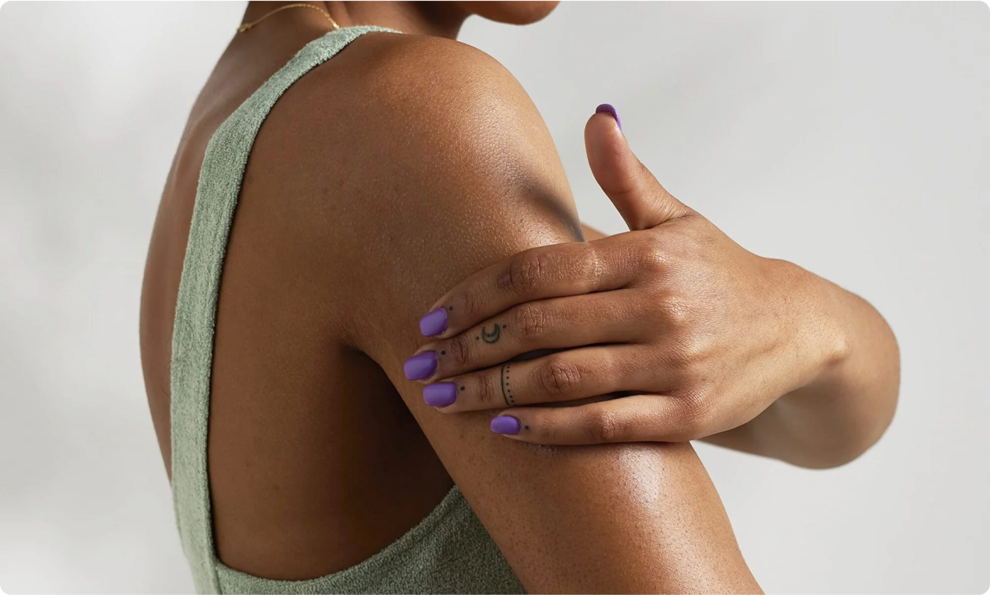 Woman with Eczema on her arm