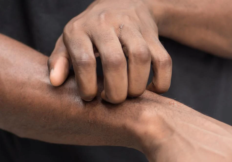 A person visibly scratching or itching their forearm, indicating itchy skin