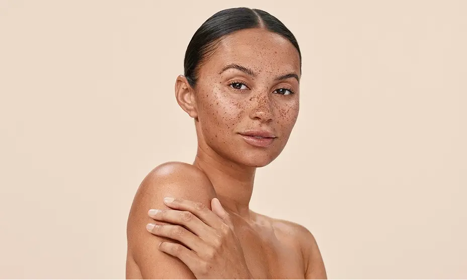 Woman with freckles showcasing daily moisturizing skincare for healthy skin.