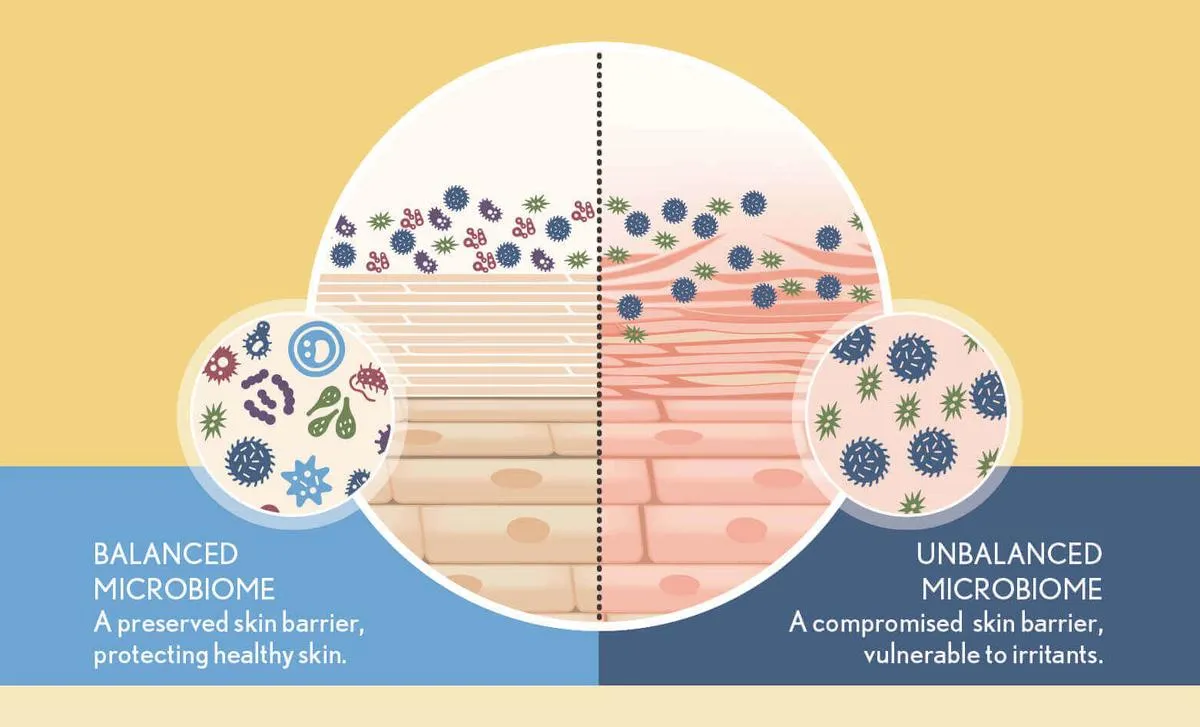 Balanced and Unbalanced Microbiome