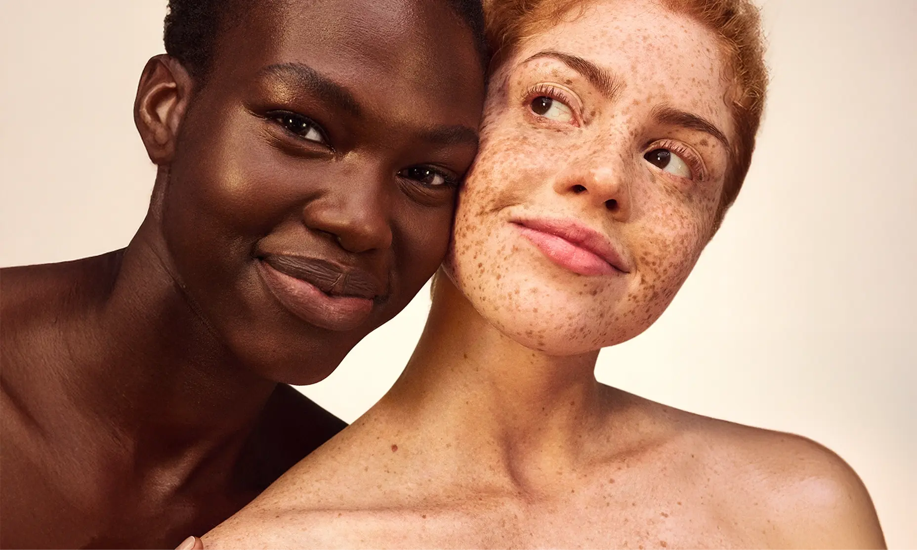 Two women with distinct freckles on their faces pose together, radiating confidence epressions