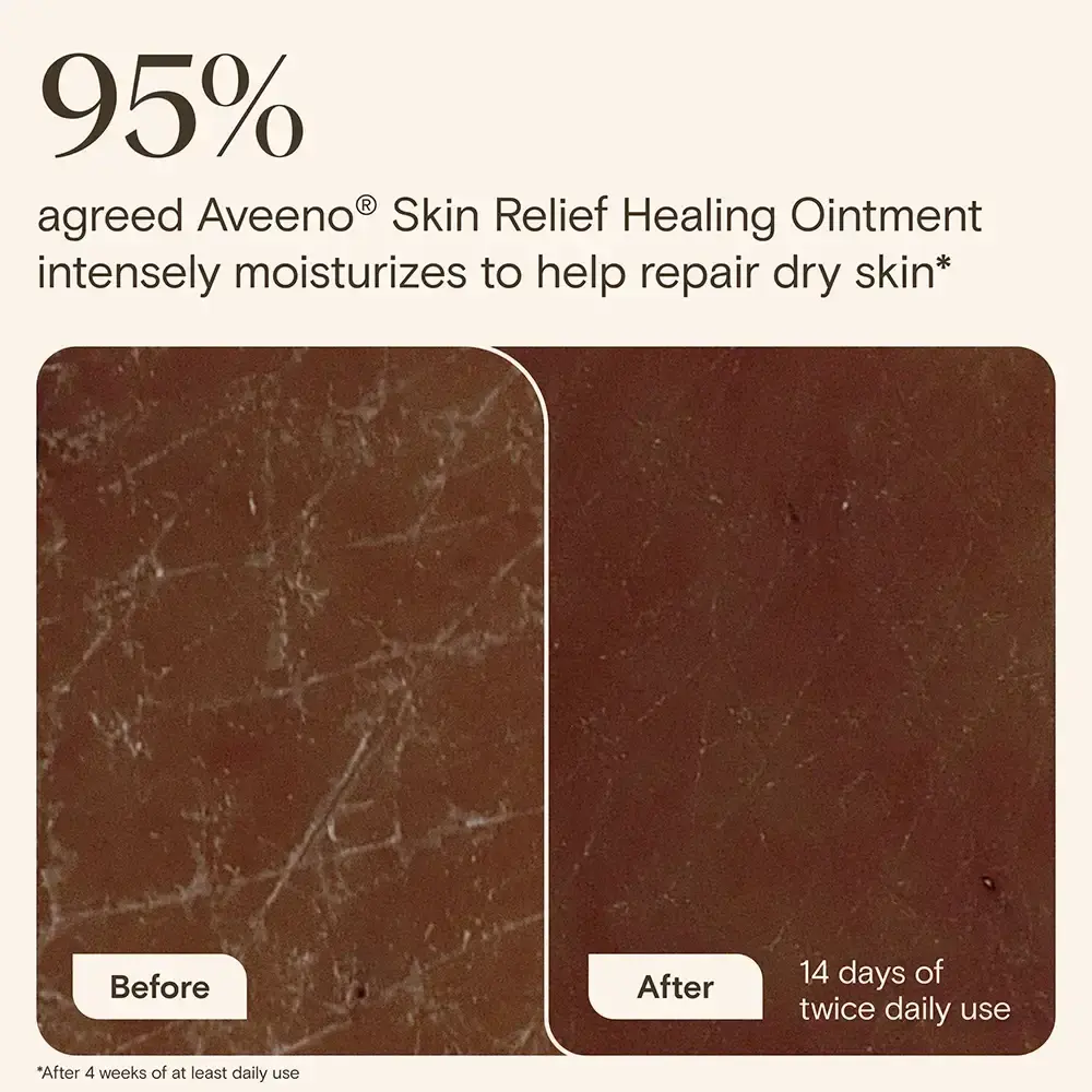95% agreed Aveeno® Skin Relief healing ointment intensely moisturizes