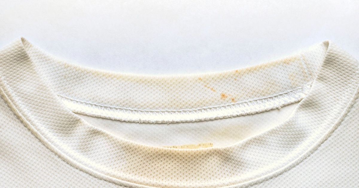 brown stains on dress shirt collar tips HELP ME!!!