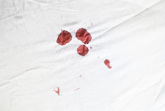 How to Get Blood Stains Out of Sheets With Bleach