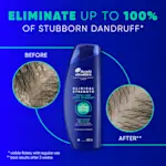 Eliminate up to 100% of stubborn dandruff (visible flakes, with regular use)