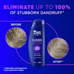 Eliminate up to 100% of stubborn dandruff (visible flakes, with regular use)