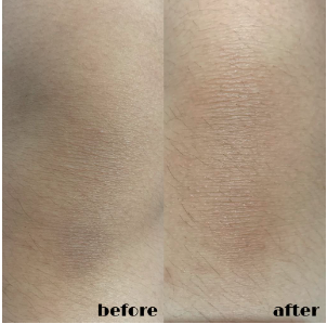 Before After Body Saver