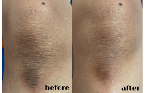 Before After Body Saver 3