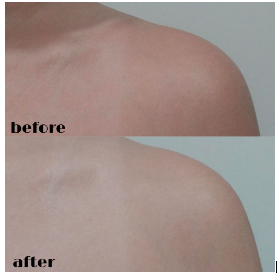 Before After Body Saver 4