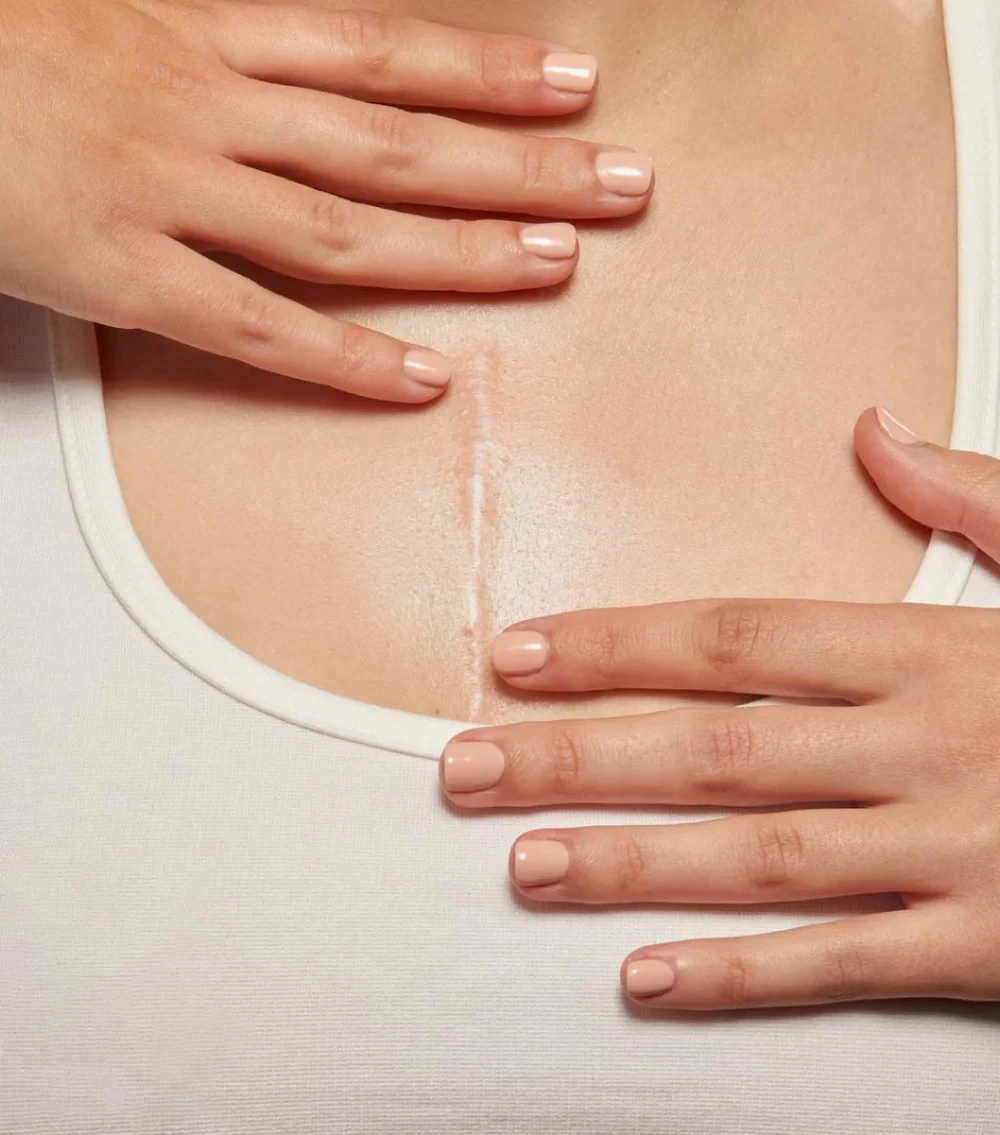 find-your-solution-scars