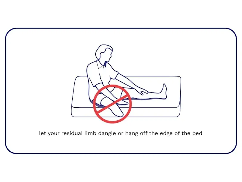 An illustration of an amputee sitting up on a bed mattress. The text accompanying the image reads, "let your residual limb dangle or hang off the edge of the bed."