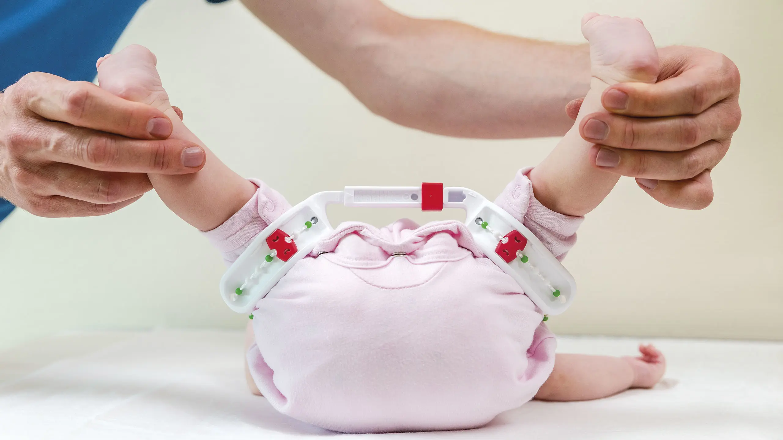 Dettaglio della posizione assunta dal bambino con l'ortesi d'anca