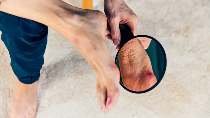 4881648-Sindrome-piede-diabetico-169 (ITA)