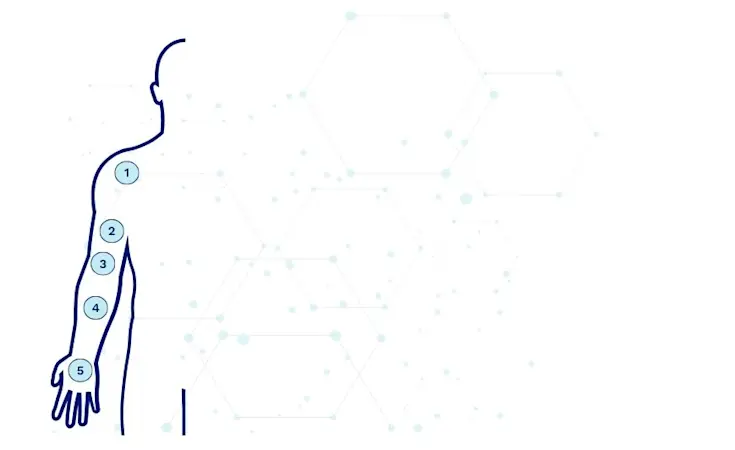 An illustration of the top half of a person with numbers indicating different amputation levels