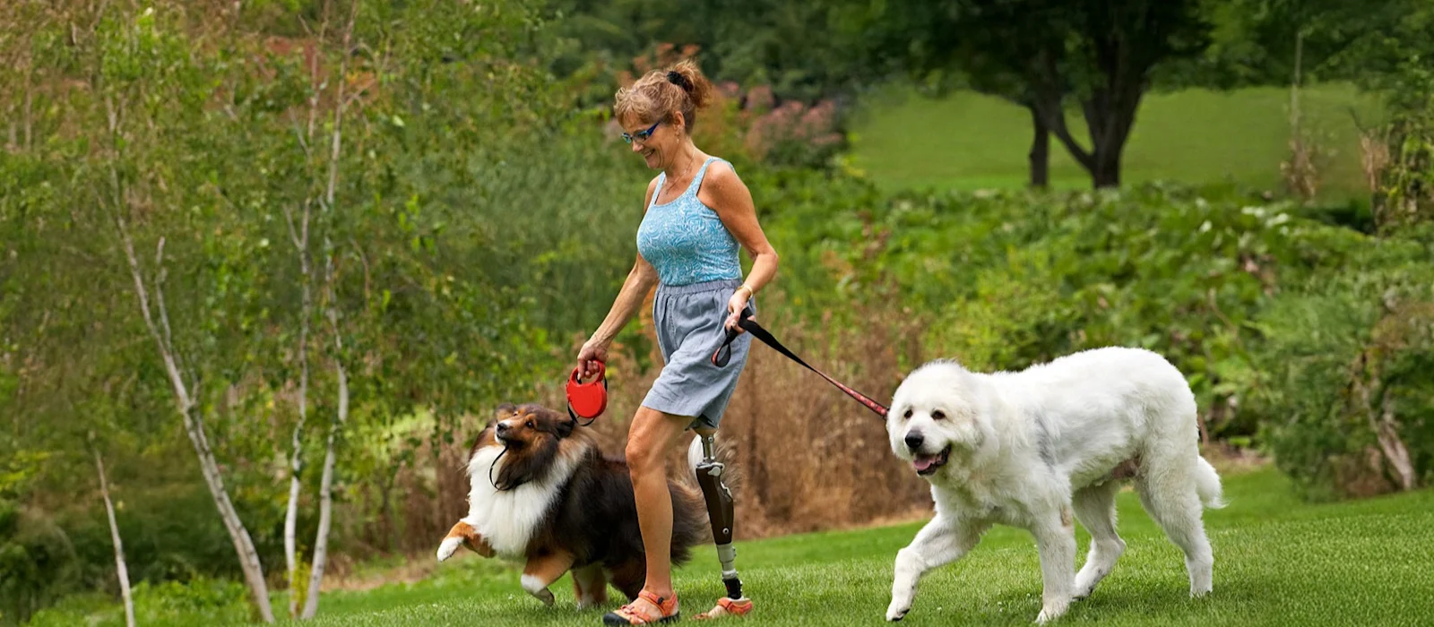Un usuario de pierna protésica paseando a sus perros en un campo al aire libre
