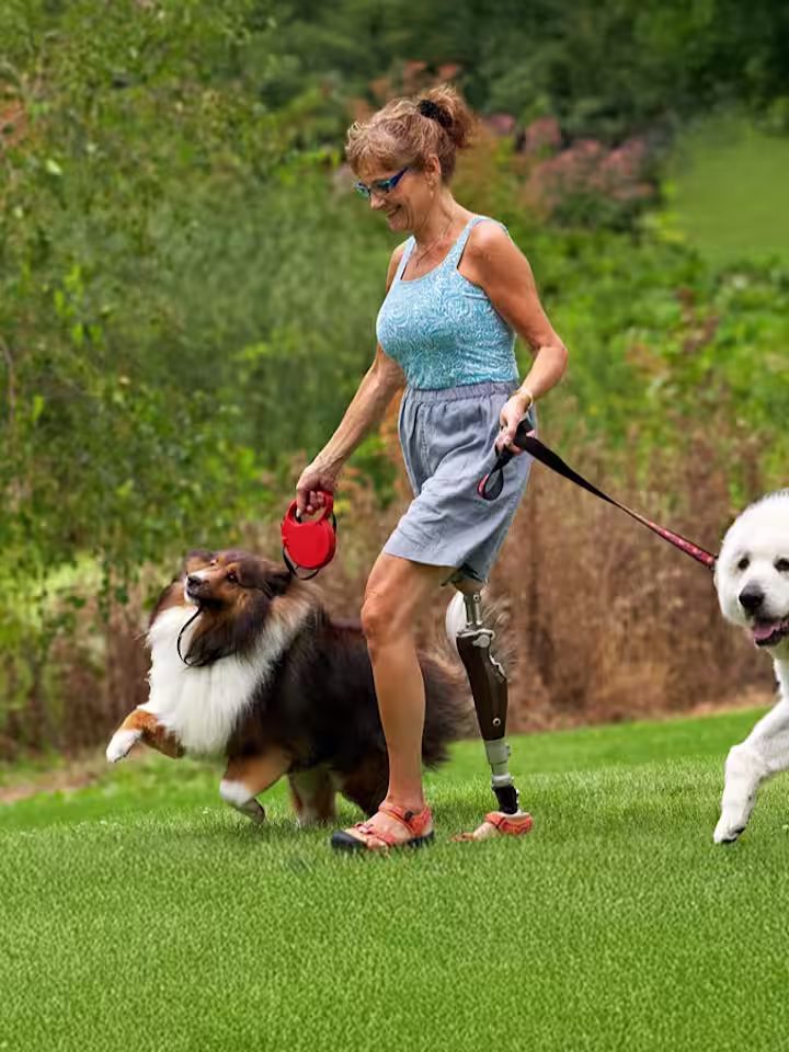 A prosthetic leg user walking her dogs on an outdoor field