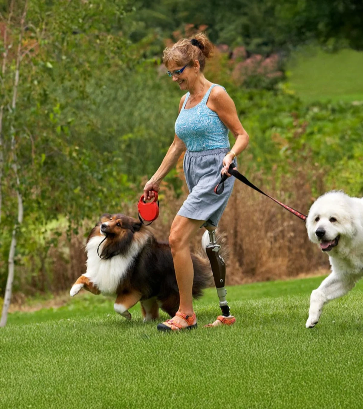 A prosthetic leg user walking her dogs on an outdoor field