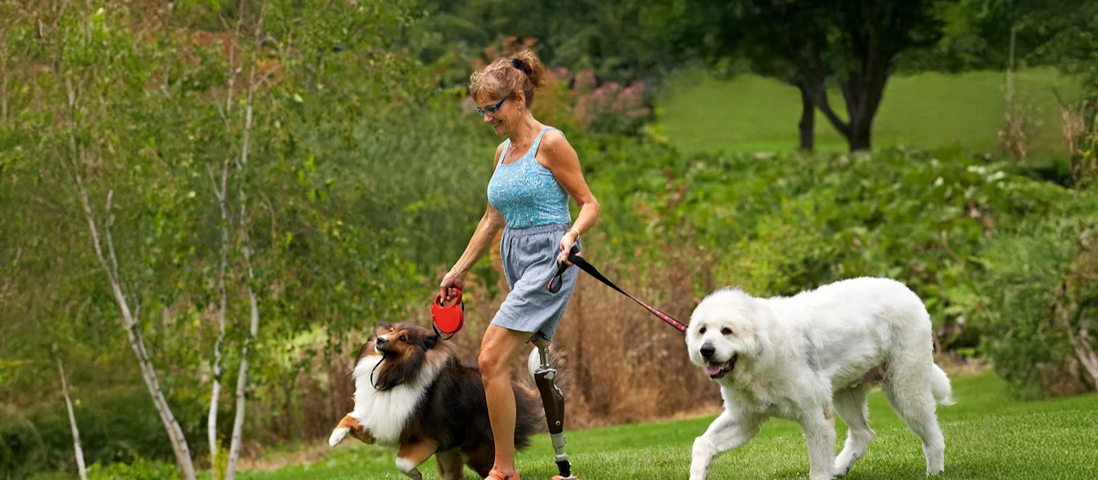 A prosthetic leg user walking her dogs on an outdoor field