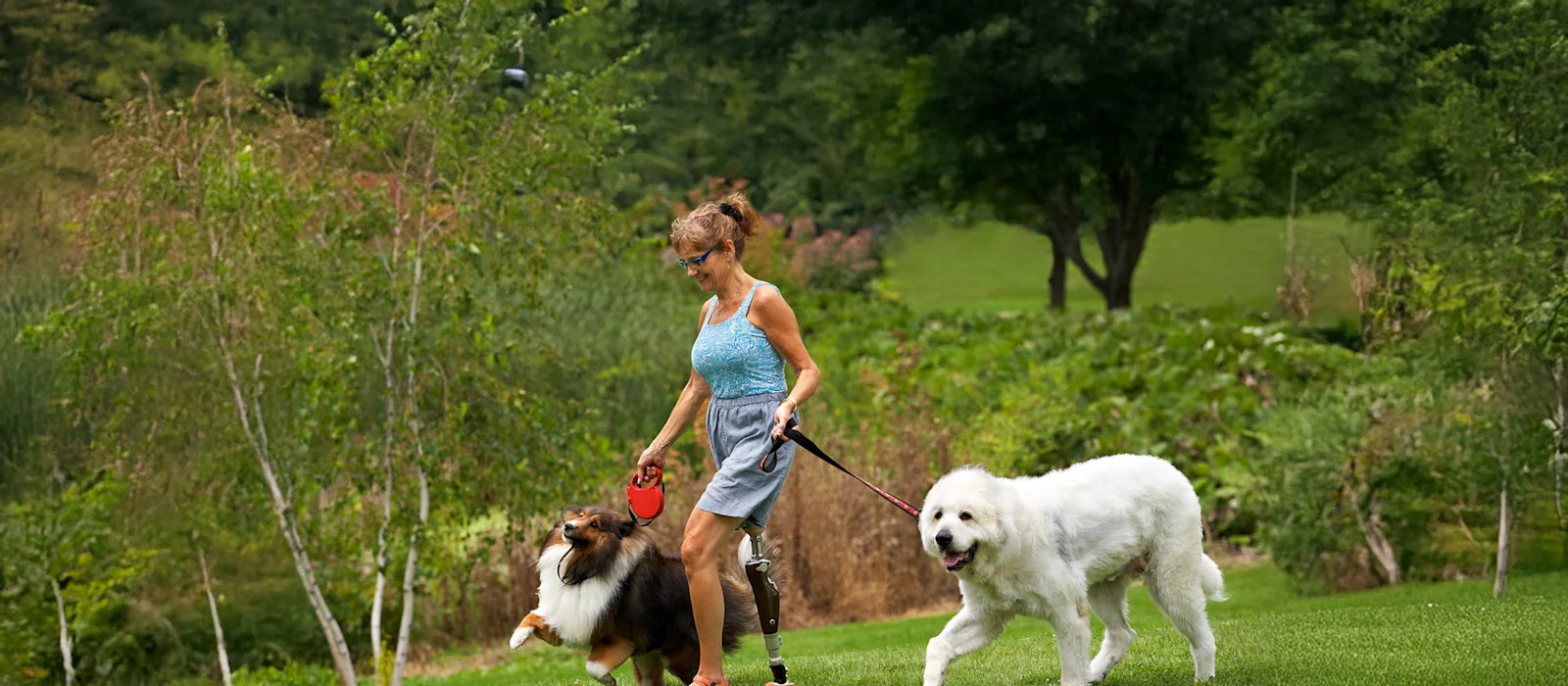 Un usuario de pierna protésica paseando a sus perros en un campo al aire libre