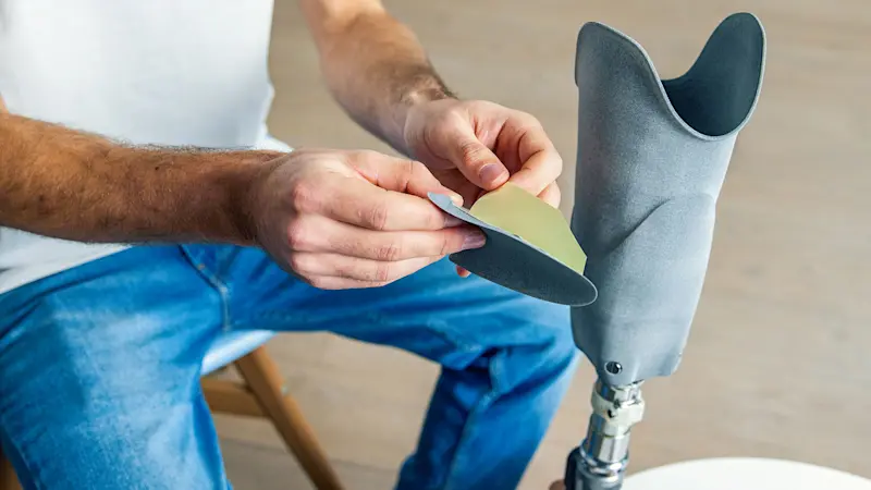 A prosthetic technician preparing a custom prosthetic socket