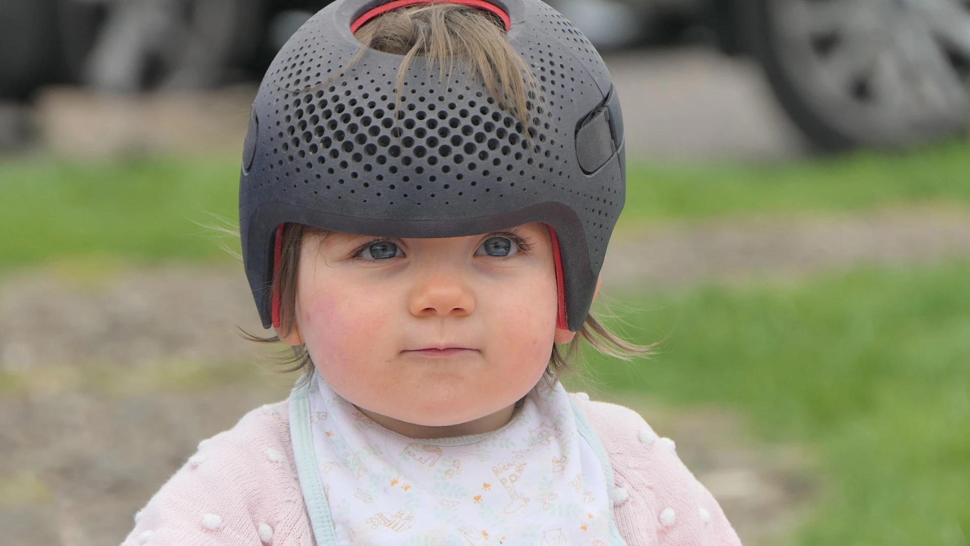 An infant wearing a personalized cranial remolding helmet to treat their Plagiocephaly 