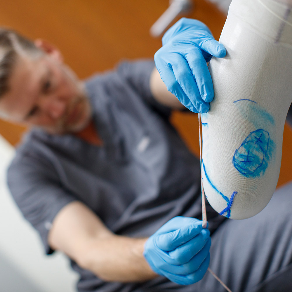 CPO Scott Sabolich midiendo un molde de muñón residual