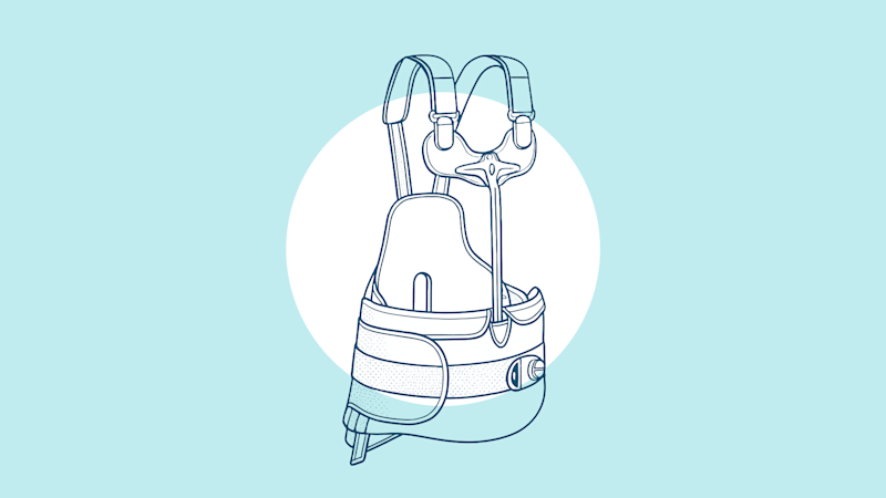 A digital image of a Custom Thoracolumbosacral Orthosis that is personalized to the patient's body shape and contours for precise support