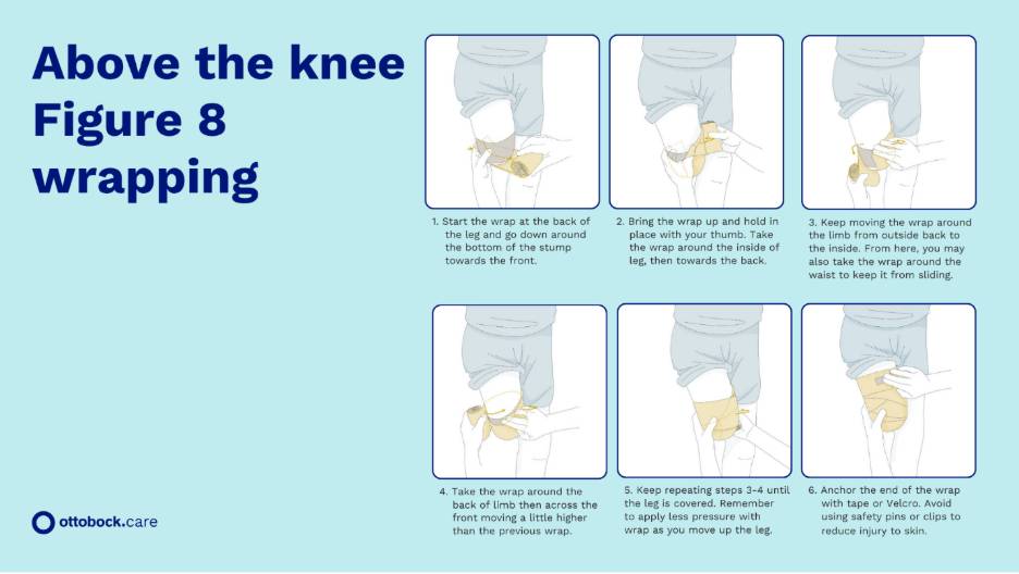 A detailed infographic providing step-by-step imagery on figure-8 wrapping for residual limbs