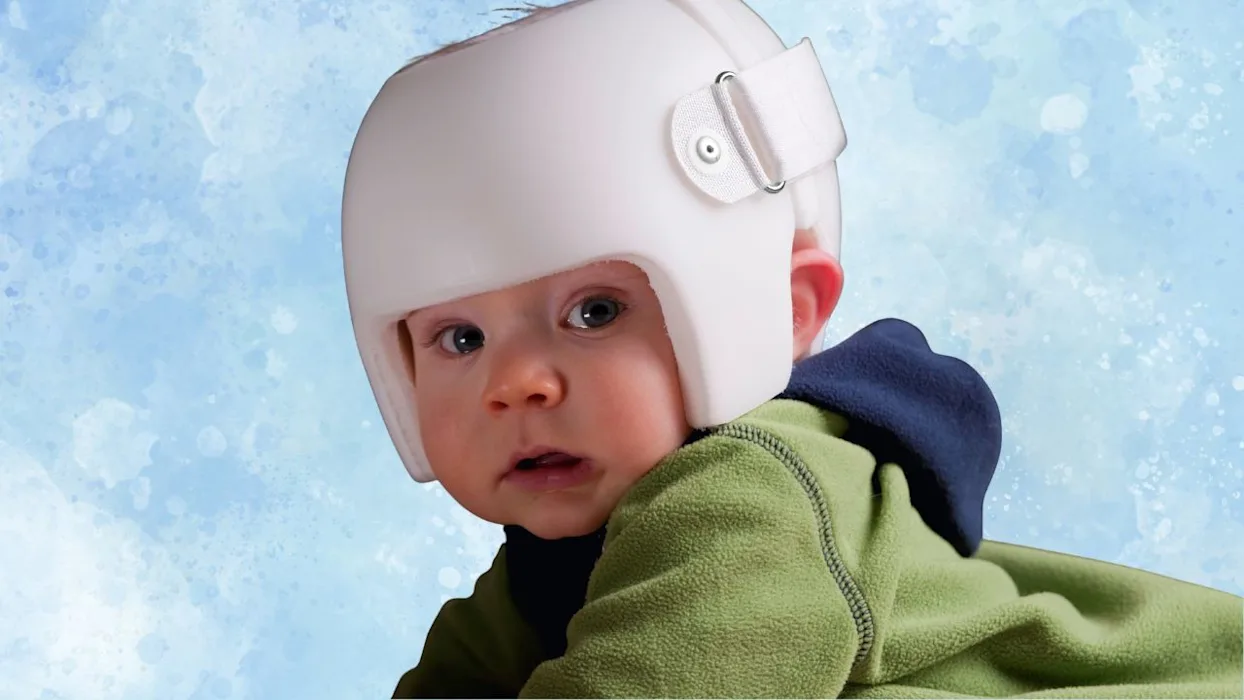 OC - Pediatrics Cranial Helmets_Stage_Teaser_Image (US)