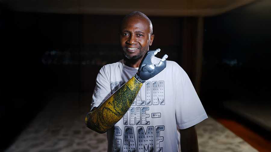 An Ottobock.care patient showing his prosthetic arm's ability to light up, demonstrating the customization of his prosthesis