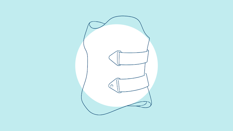 A graphic of a Thoracolumbosacral Orthosis, used as a torso brace to provide stability and limit movement