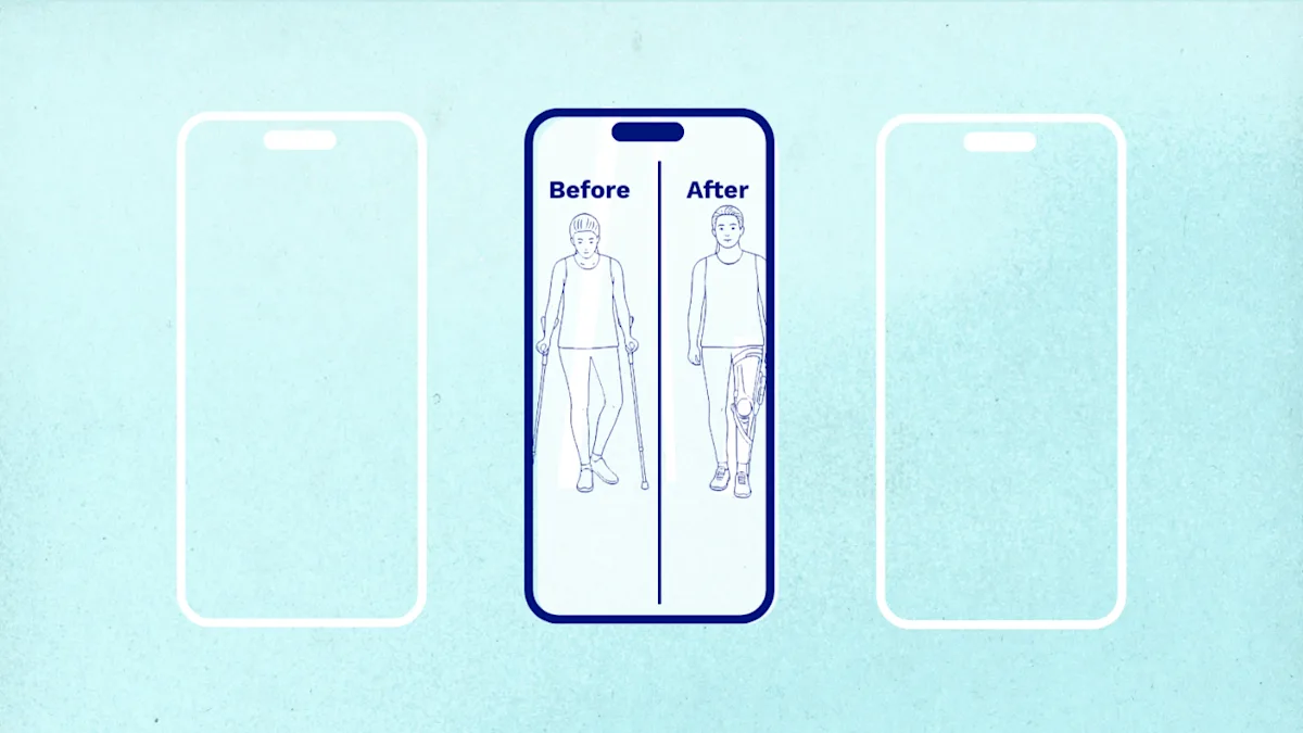 Una representación gráfica del video del antes y después con un modelo de paciente demostrando su marcha con y sin la c-brace