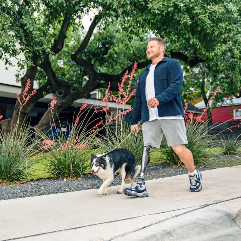 An above-knee amputee walking their dog on a sidewalk in their C-Leg microprocessor controlled knee