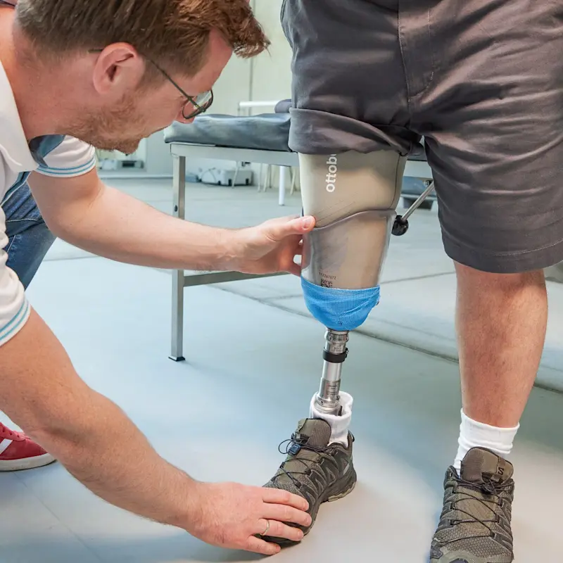 A Certified Prosthetist Orthotist tinkering with a prosthetic socket