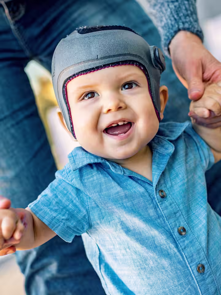 A child wearing a cranial helmet while playing with their parents