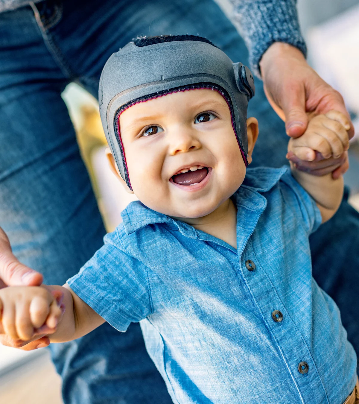 A child wearing a cranial helmet while playing with their parents