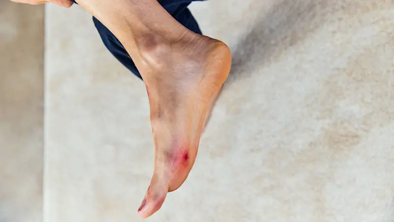 4881902-Sindrome-piede-diabetico-169 (ITA)