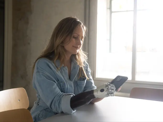 A woman with an upper limb amputation browsing on her phone with a prosthetic hand