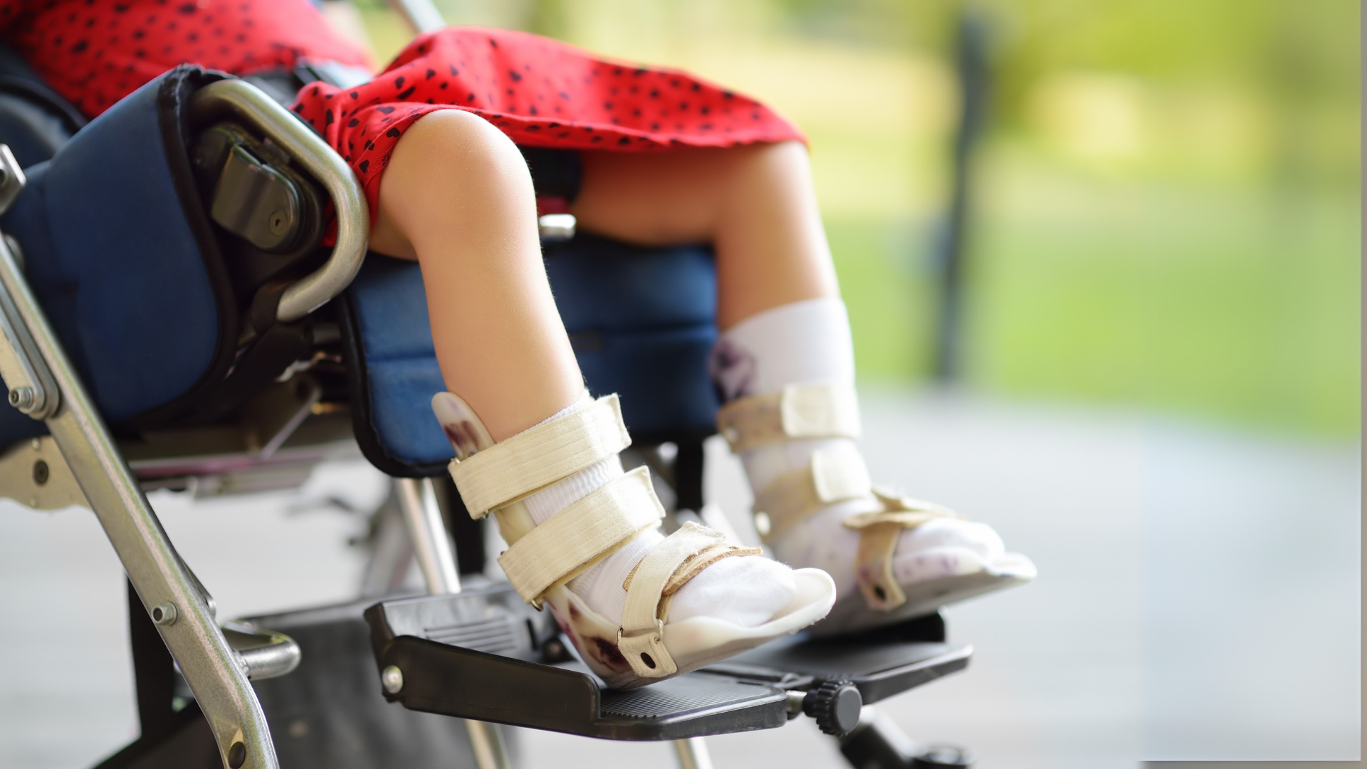 OC - Blog | Celebrating Disability Pride Month_3 Ways Disability Pride Inspires Us All_3_Image (US)
