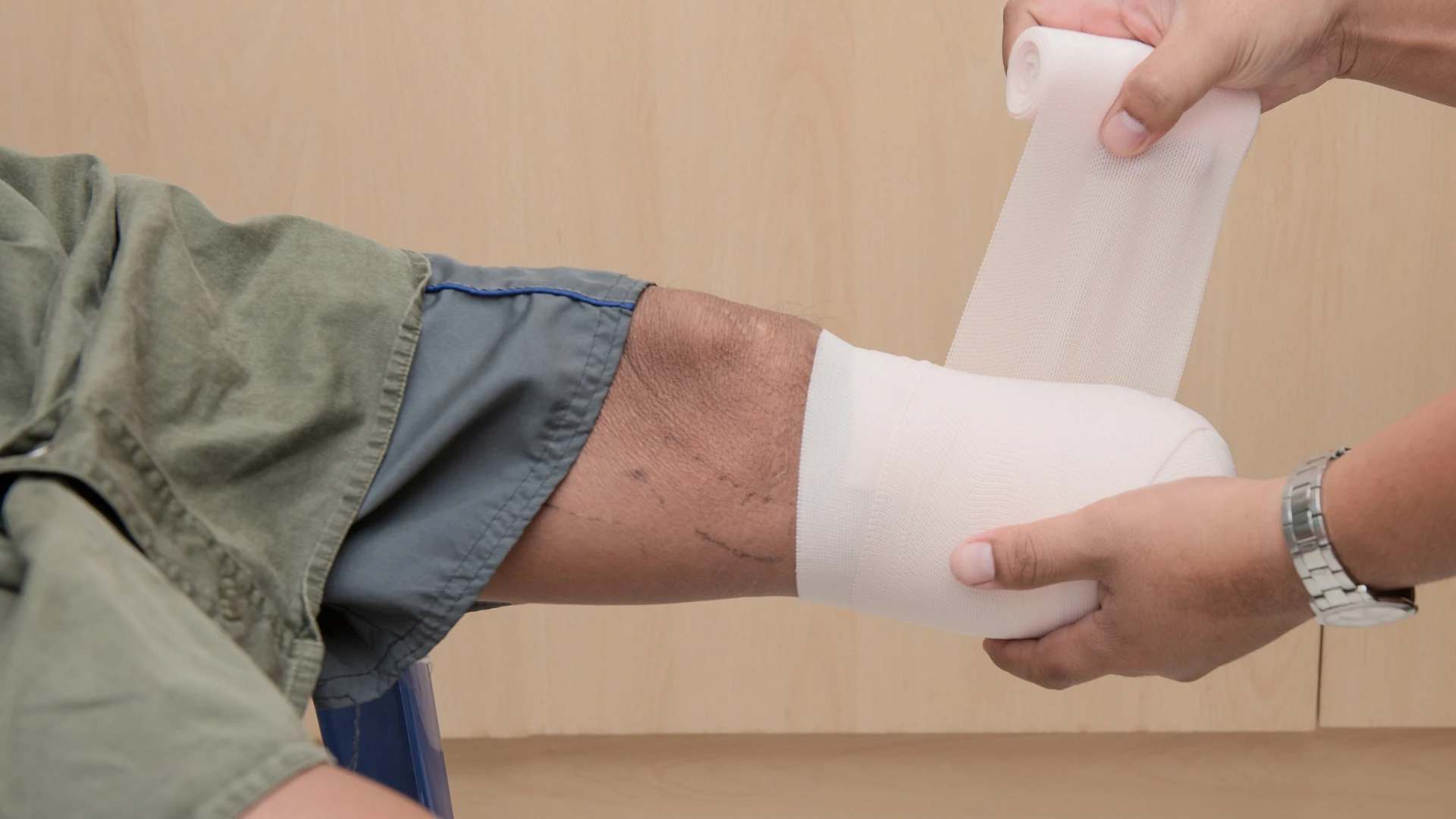 A patient's residual limb being wrapped by bandages